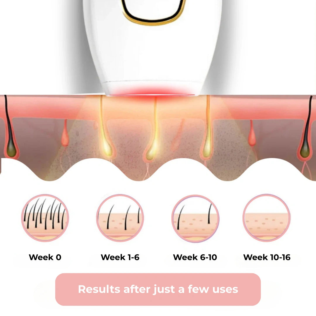 HairLess IPL - Permanent Hair Removal